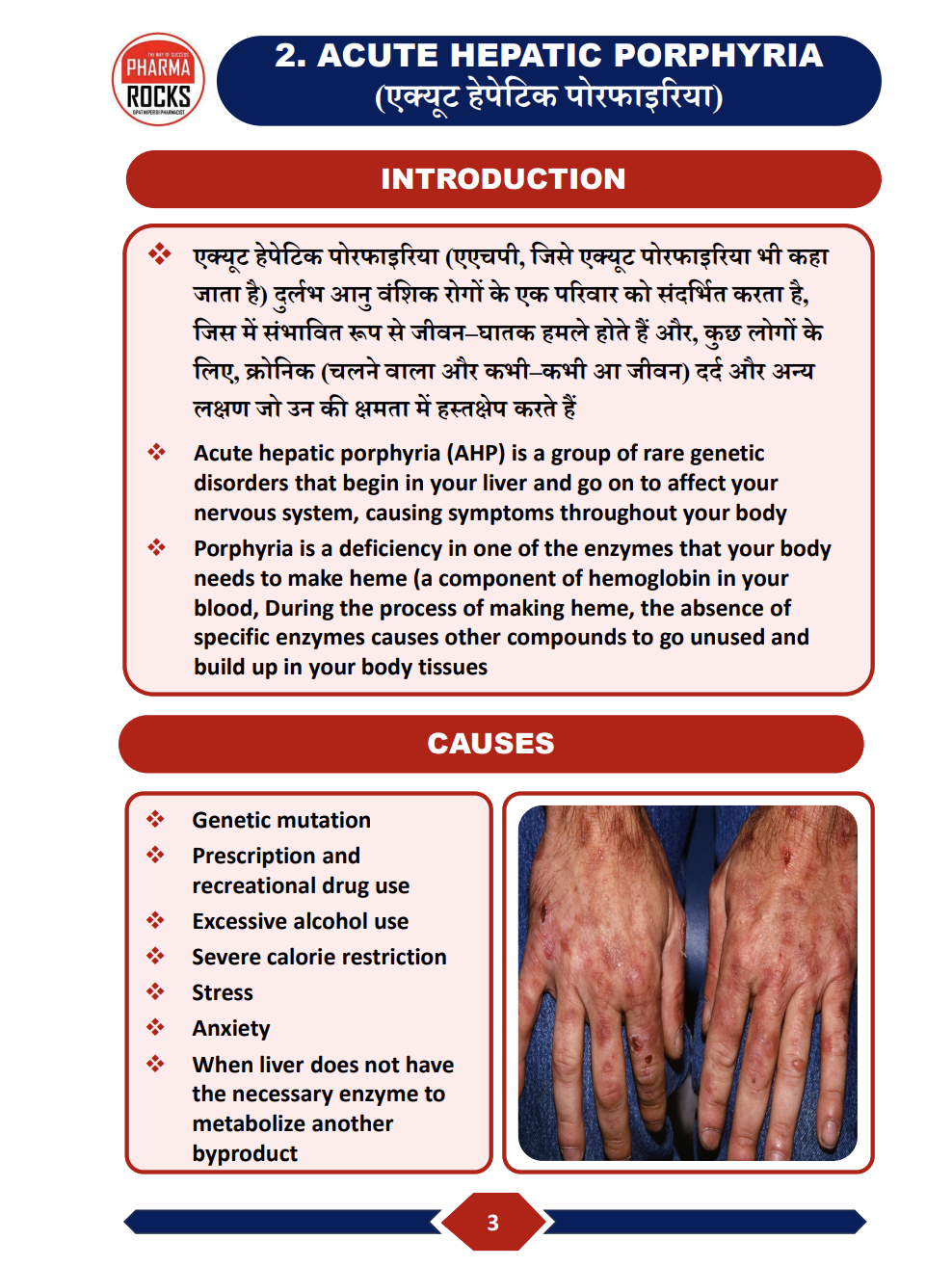 Acute Hepatic Porphyria — परिचय और कारण का actual handbook sample page