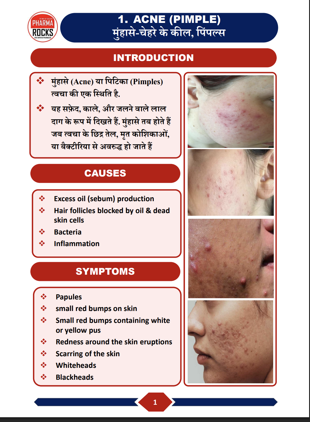 Acne — परिचय, कारण और लक्षण का actual handbook sample page